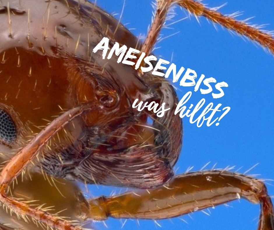 ameisenbiss hausmittel
